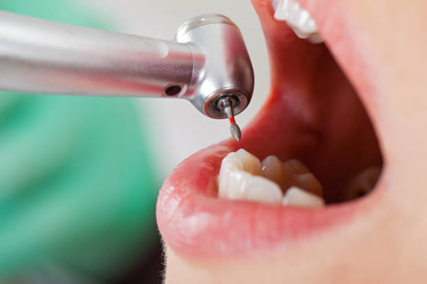 Best Emergency Treatment for Toothache in Conway, FL